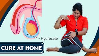 इन योग से ठीक होगा हाइड्रोसील घर बैठे  Best YOGA POSES to CURE Hydrocele at Home FAST  Yogawale [upl. by Seiden]