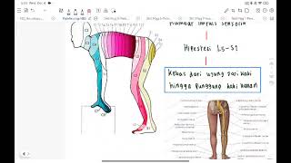 PATOFISIOLOGI NBS CASE 4 quotLBP ec HNPquot  ray [upl. by Horick]