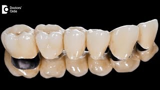 What is difference between composite and GIC cements in dentistry  Dr Harish B [upl. by Orling]