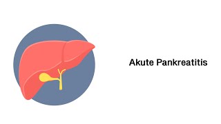 Akute Bauchspeicheldrüsenentzündung Akute Pankreatitis [upl. by Masha]