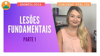 LESÕES FUNDAMENTAIS NA ODONTOLOGIA  PARTE 1 CONCURSO PÚBLICO [upl. by Agnes977]