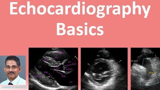 Echocardiography Basics [upl. by Fasa]