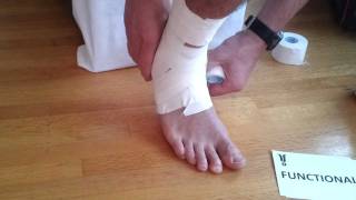 Ankle Taping  Tape Your Own Ankle COMPLETE [upl. by China]