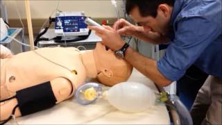 RSI part 3 Intubation [upl. by Shotton]