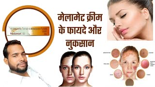 Melamet cream  Melamet cream uses in Hindi  Melamet cream ke fayde  दाग धब्बों के लिए [upl. by Chaudoin90]