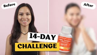 Watch the dAlpha Tocopherol Myra E 14Day Challenge [upl. by Yekim]