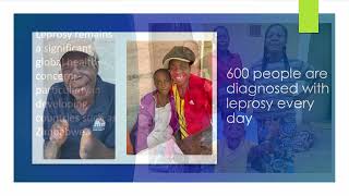 World Leprosy Day 2024 [upl. by Ramedlav299]