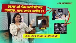 OSMF को ठीक करने की नई तकनीक अल्ट्रा साउंड मशीन ultrasound [upl. by Durgy78]