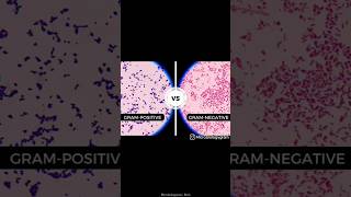 Gram stain  Gram stain procedure manual  medical shortvideo viralvideo microbiology mbbs [upl. by Leinto]