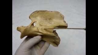 Cervical vertebrae by dr khaled shoghy [upl. by Llerreg771]