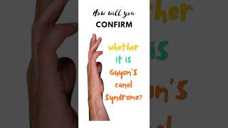 Confirmatory test for Guyon’s canal syndrome Froment’s test Ulnar tunnel syndrome shorts [upl. by Henri51]