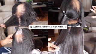 ALOPECIA NO PROBLEM HOW I COVERED ALOPECIA WITH NATURAL HAIR SILK PRESS [upl. by Olihs]