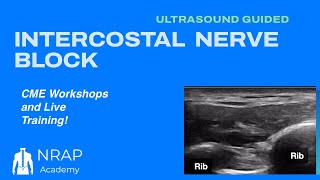 NRAP Academy Ultrasound Guided Intercostal Nerve Block for PostMastectomy Pain Syndrome￼￼ [upl. by Retepnhoj]