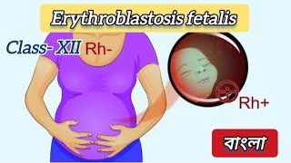 What is Erythroblastosis Fetalis Why is Erythroblastosis Fetalis fatal for Second Pregnancy [upl. by Dranik167]