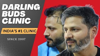 Hair Transplant in Chandigarh Best hair transplant clinic [upl. by Kenleigh]