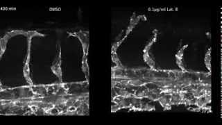 Dorsal migration of endothelial cells in zebrafish development [upl. by Alyakcim]