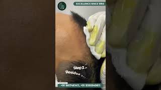 PRP Sessions after Hair Transplant  PRP for Hair Growth  Dr Sameer Pundeer  Mahendra Hair amp Skin [upl. by Sew]