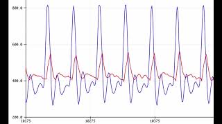 2 Pulse Sensor Amped Showing Pulse Transit Time foot and hand [upl. by Nathanael888]