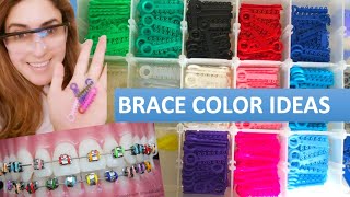 Brace Color Ideas and Tips for 2020 [upl. by Nirrac]