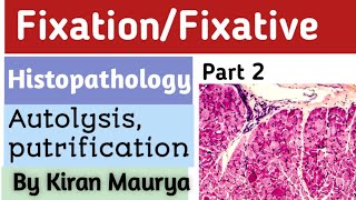 Fixative Fixation histopathology methanol ethanol Autolysis by Kiran maurya [upl. by Almund622]