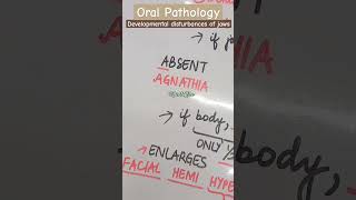 Developmental disturbances of jaws  Oral Pathology  Shafers chapter 1 shortvideo shorts [upl. by Eedyak]