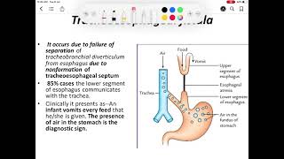 Development of esophagus [upl. by Maltzman]