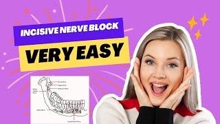 INCISIVE NERVE BLOCK PROCEDURE  Everything you need to know [upl. by Nodla]