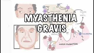 Myasthenia gravis History mrcpch Clinical [upl. by Aitret890]