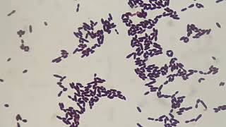 Gram staining of Enterococcus [upl. by Giulio839]