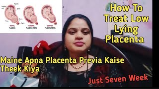 मैंने अपना placenta Preavia कैसे ठीक कियाhow to treat Low lying placenta dailyvlogLs official [upl. by Wanids]