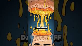 🧠quotHow Does Dandruff Form The Surprising Truth Explained 🤔quot facts [upl. by Enorel301]