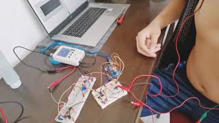 ECG de 6 derivaciones con multiplexación [upl. by Oznerol]