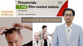 Finasteride Side effects  Finasteride का सही dose Finasteride results  Finasteride tablets ip 1mg [upl. by Nibaj72]