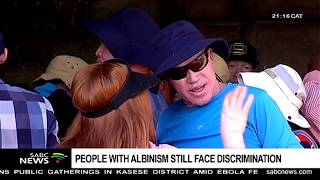 People with albinism still face discrimination [upl. by Eelatsyrc]