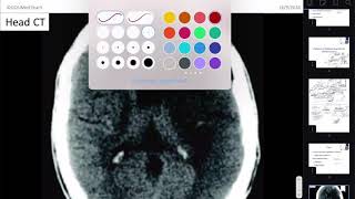 Neuropathology [upl. by Cerellia]