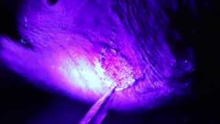 Tips for photographing ringworm using ultraviolet light [upl. by Zilber]