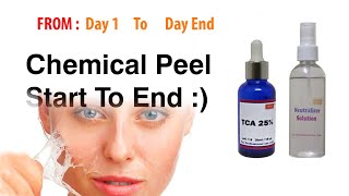 Chemical peel at Home Rejsol 25 Tca [upl. by Innavoig617]