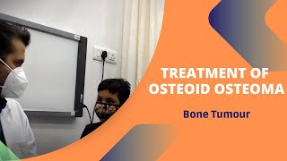 Treatment of Osteoid Osteoma  JIPSI Health  Bone Tumour [upl. by Nnaeirrac]