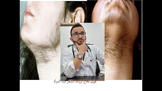 أحسن علاج لزيادة الشعر عند المرأة le meilleur traitement pour lhyperpilosité [upl. by Aiuhsoj607]