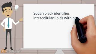 Sudan black stain in acute myelogenous leukemia [upl. by Naols]