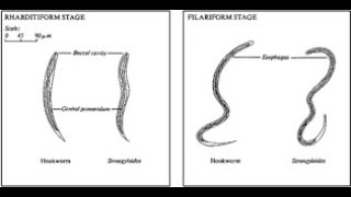 Differentiating Hookworm from Threadworm [upl. by Esertak488]