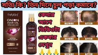 সত্যিই কিতিন দিনের চুল পড়া কমাবেfriyias onion hair oil review🥰best hair oilhairfall hair oil🥰 [upl. by Izaak]