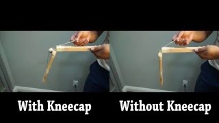 What Are Kneecaps For  Discover How Crucial It Is For Kneecap Mobilization [upl. by Fezoj212]