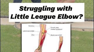 How To Identify The Scary Little League Elbow [upl. by Delp]