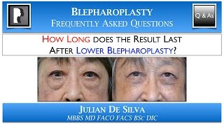 HOW LONG does the result last after Lower Blepharoplasty How many YEARS lower eyelid surgery last [upl. by Odlonra]