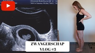 EERSTE ECHO amp MISSELIJK  6 7 amp 8 weken  ZWANGERSCHAP VLOG 3 [upl. by Ybbor]