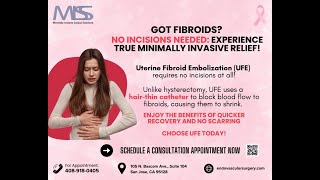 No Incisions Needed Hysterectomy VS UFE for Fibroids [upl. by Anaihr291]