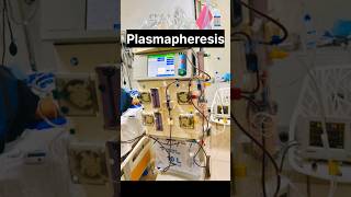 Plasmapheresis With Advanced Dialysis Machine nephrology kidneyhealth kidneydisease ytshorts [upl. by Niatsirhc]