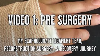 Scapholunate Ligament Tear and Reconstruction  Video 1 PreSurgery [upl. by Tonie]