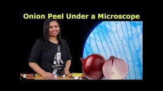 Onion Peel Under the Microscope  How to Prepare Stained Temporary Mount of Onion Peel trending [upl. by Sima941]